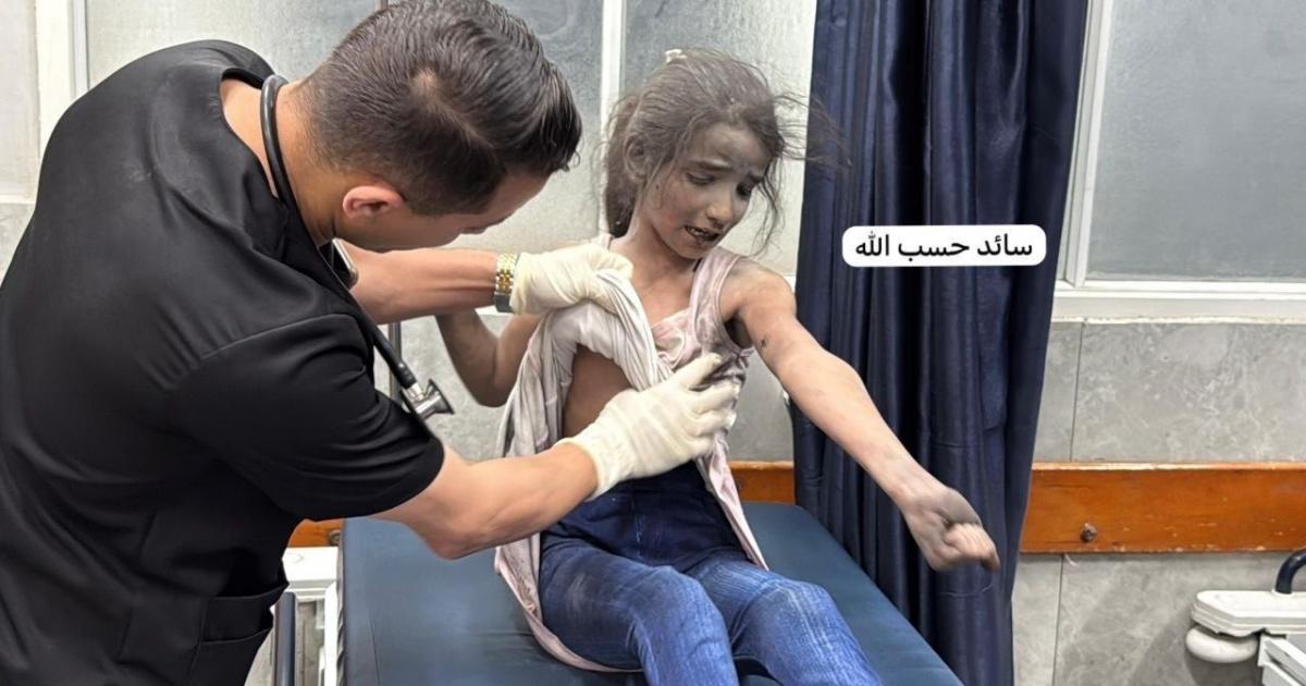 اصابة 7 مواطنين من بينهم اطفال في قصف اسرائيلي استهدف قطاع غزة