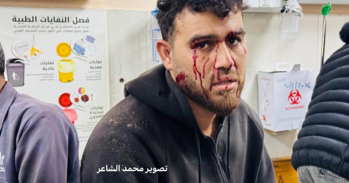 خروقات متواصلة.. شهيد ومصابون بقصف من مسيرة إسرائيلية غربي خانيونس
