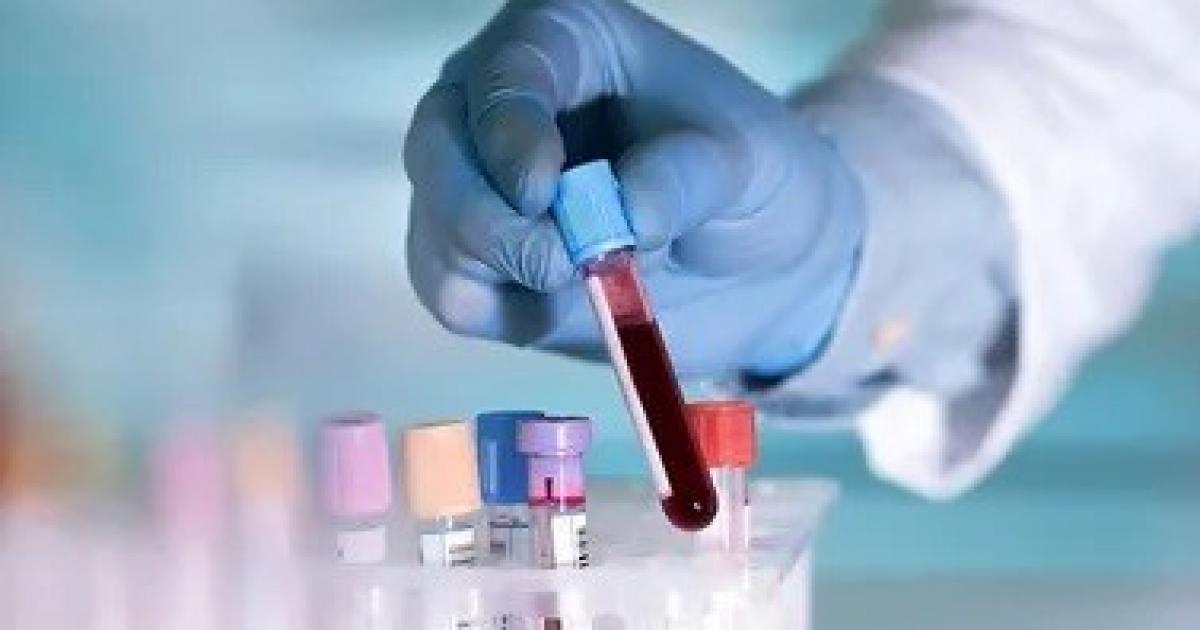 نتائج تفوق التوقعات.. علاج يحقق استجابة قياسية لمرضى سرطان الدم