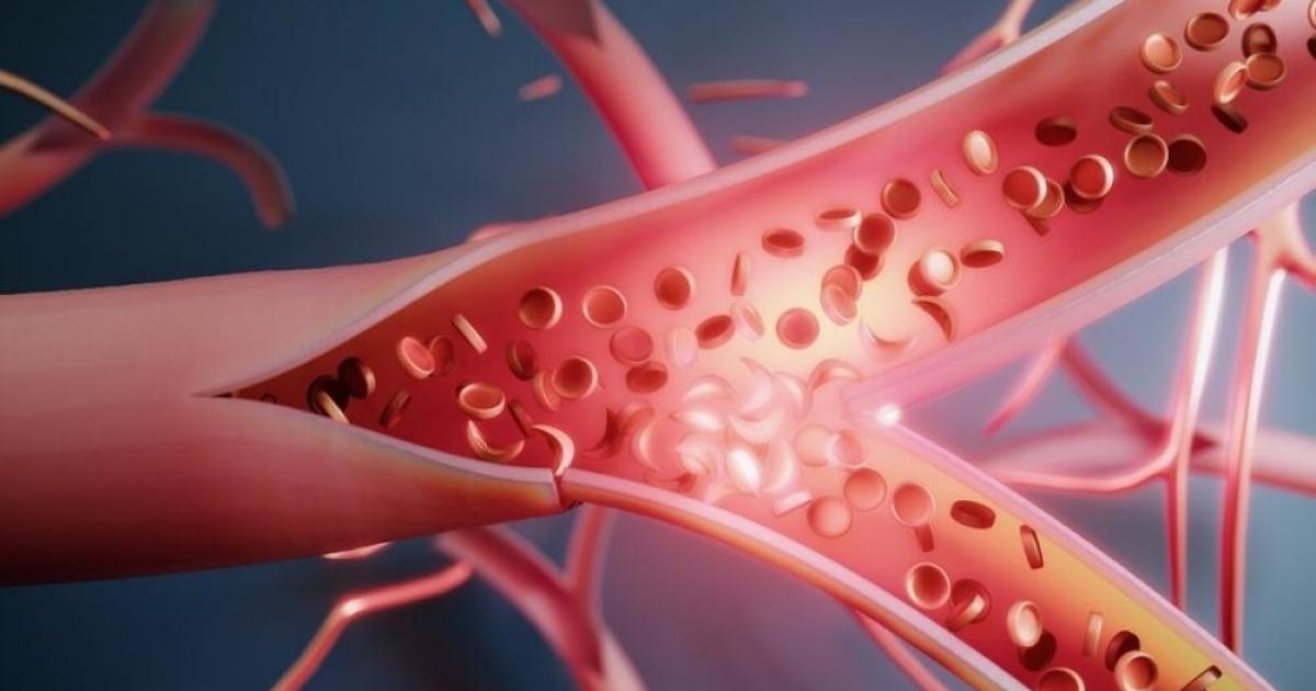 علاقة مثيرة للجدل بين مستويات B12 والسرطان