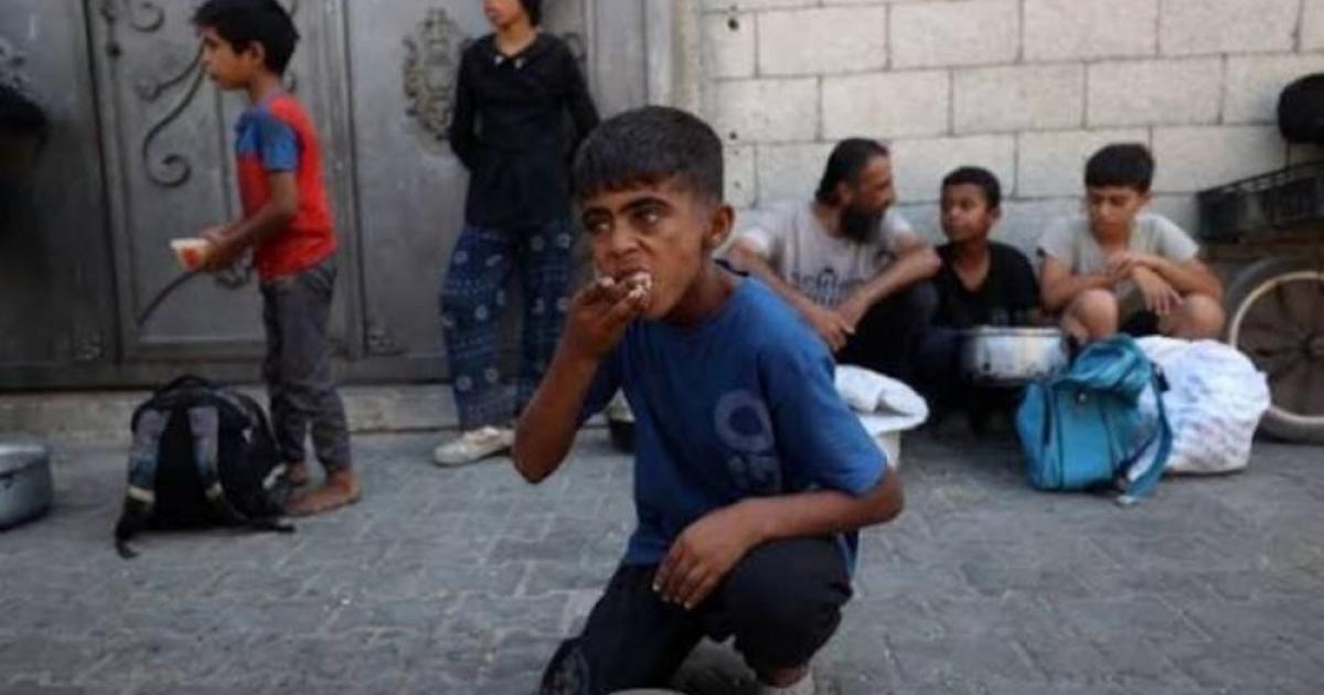 الأمم المتحدة: سوء التغذية يتفاقم بين أطفال غزة