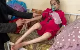 202404mena_palestine_gaza_n_malnutrition.webp