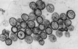 hantavirus.jpg