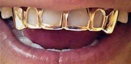 سرقة اسنان ذهبية 