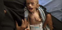 وفاة اطفال اليمن 