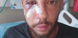 7fecacd8-329c-48a6-93d1-02e708a83960