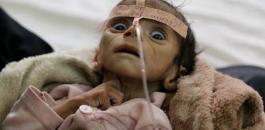 مجاعة في اليمن 