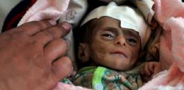 مقتل اطفال في اليمن 