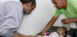 أطباء بلاحدود: تضرر مئات المرافق الصحية جراء الحرب في اليمن 