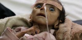 الامراض في اليمن 
