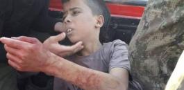 ذبح طفل فلسطيني 