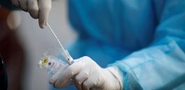 الطب الوقائي والاصابة بفيروس كورونا في جنين 