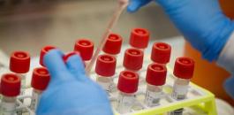 اصابات كورونا