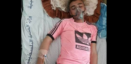 غاز مجهول اطلقه الاحتلال يسبب تشنجات واضرابات عصبية لشاب منذ 6 أيام