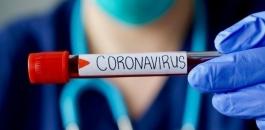 فحوصات فيروس كورونا 