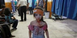 Douma_AFP