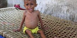 المجاعة في اليمن 