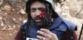 اصابة مصور صحفي في صوريف 