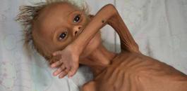 الاطفال في اليمن 