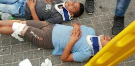 إصابة 4 أطفال بجروح بعد أن دهسهم مستوطن في سلوان بالقدس