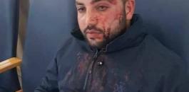 اعتداءات المستوطنين على المواطنين الفلسطينيين 