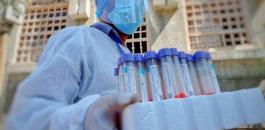 07d30c8a6c355c7e970247a026825e82