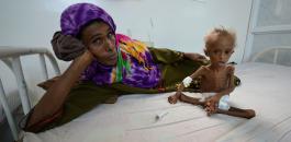 مساعدات المانية لاطفال اليمن 
