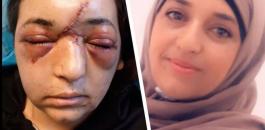 جندي اسرائيلي يكسر جمجمة سيدة فلسطينية 