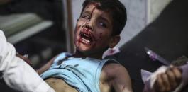 400 قتيل مدني في الغوطة الشرقية