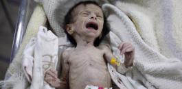 جوع أطفال اليمن 
