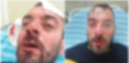 زوجة شاب تعرض للضرب 