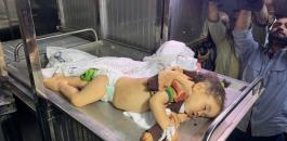 استشهاد طفلة في غزة 