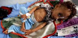 الامم المتحدة والجوع في اليمن 