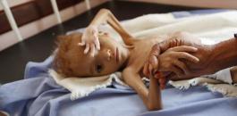 المجاعات في اليمن