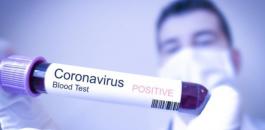 coronavirus-cdc.jpg