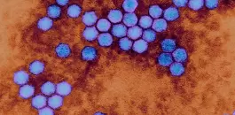 فيروس شلل الاطفال