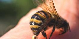 732x549_How_Is_An_Infected_Bee_Sting_Treated.jpg