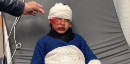 اصابة طفل بهجوم للمستوطنين