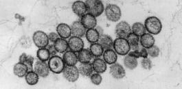 hantavirus.jpg