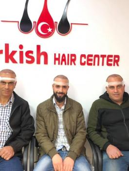 المركز التركي لزراعة الشعر والتجميل رام الله 