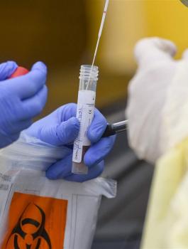 اصابات بفيروس كورونا في غزة 