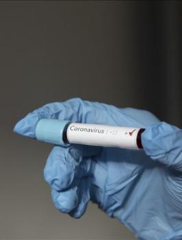 وفيات كورونا في مصر 