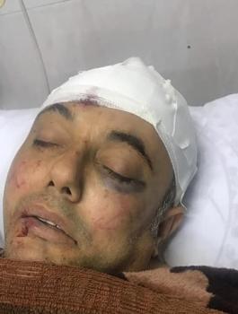 الاعتداء على عاطف ابو يوسف 