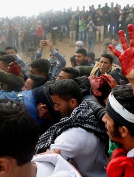 الصحة: 112 شهيد وأكثر من 13 ألف جريح منذ مارس الماضي