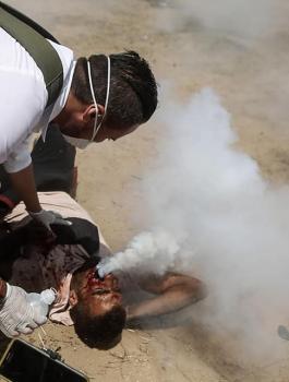 أكثر من نصف الجرحى أصيبوا برصاص متفجر على حدود غزة