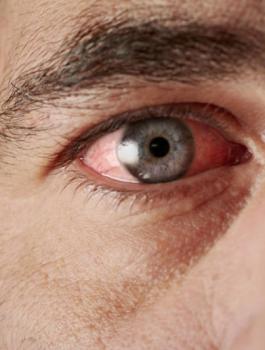 شاب يبكي دماء 