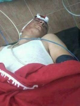 اصابة شاب بجراح خطيرة في نابلس 
