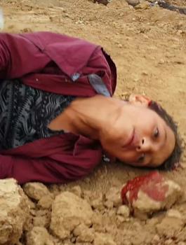 أمريكا تقود تحقيقاً دولياً لجرائم الاحتلال في غزة