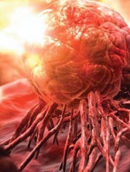 الاسبرين والسرطان 