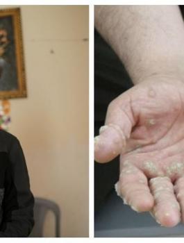 رجل الشجرة في غزة 